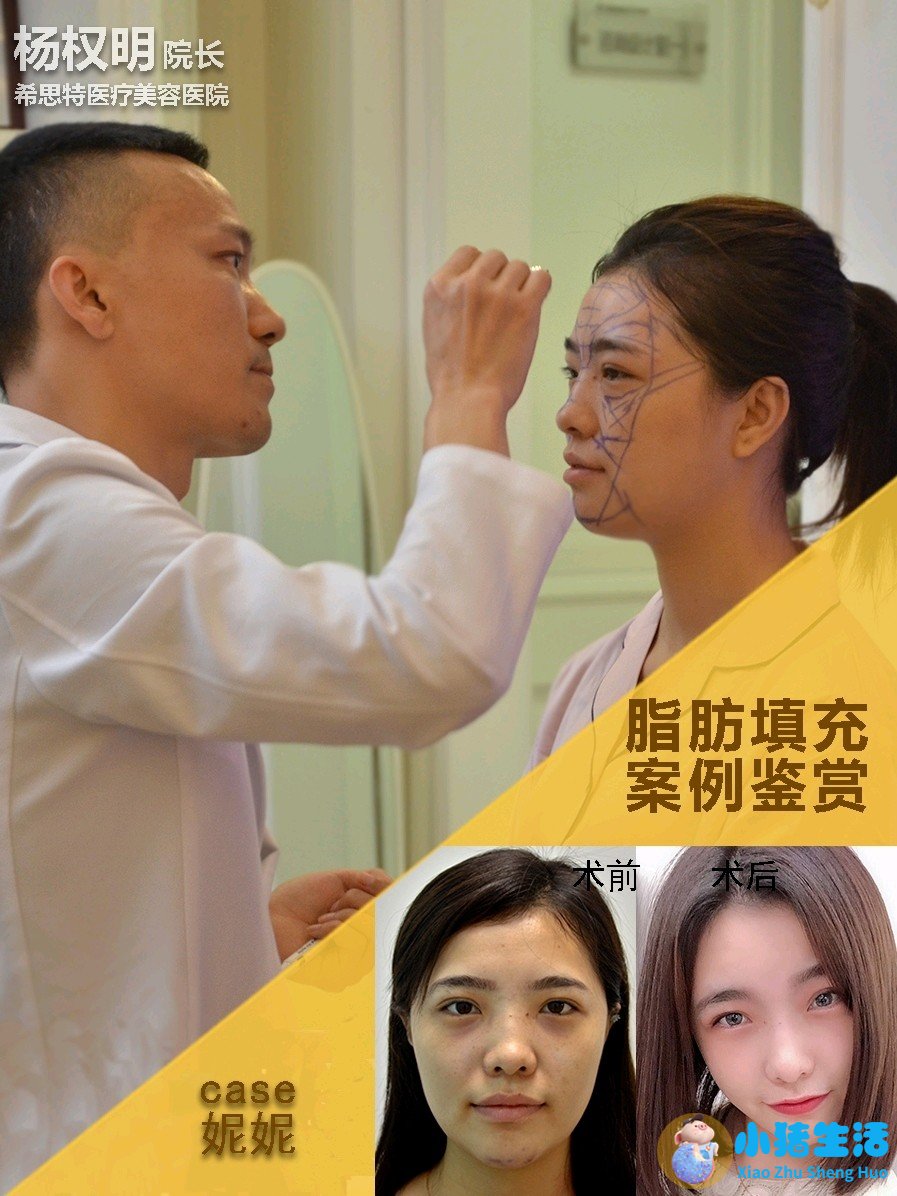 长春中妍赵胜有整形失败案例