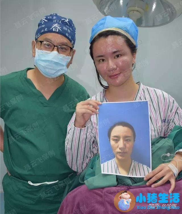 长春中妍赵胜有整形失败案例