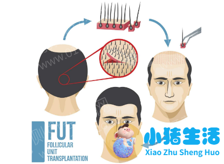长春中妍赵胜有整形失败案例
