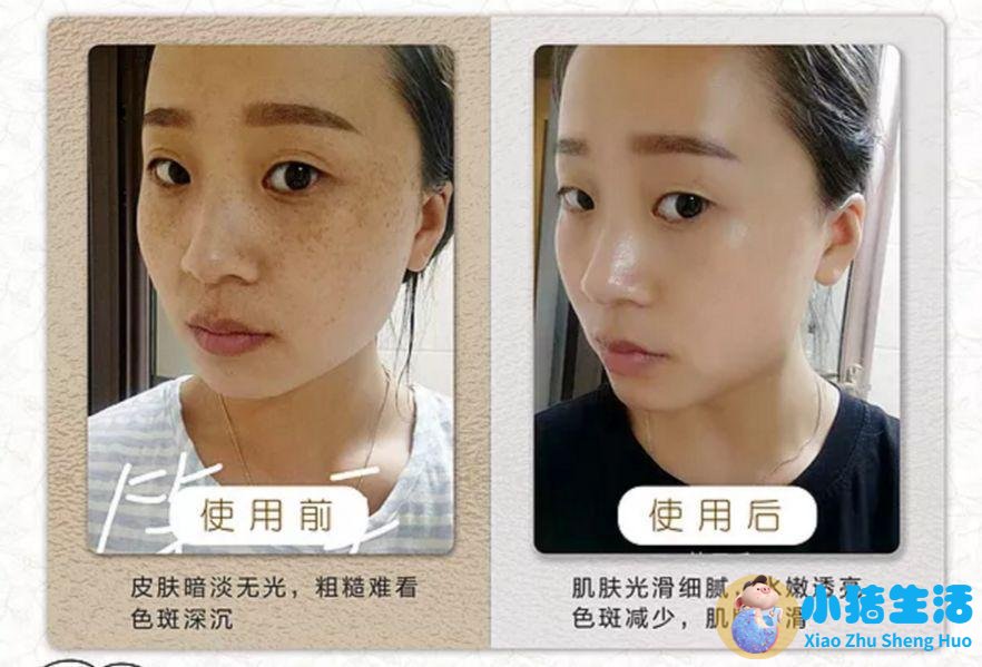 英树羊胎素面膜好用吗
