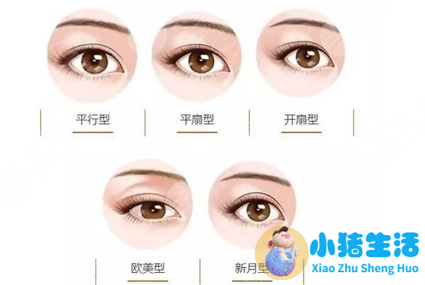 平扇形双眼皮介绍