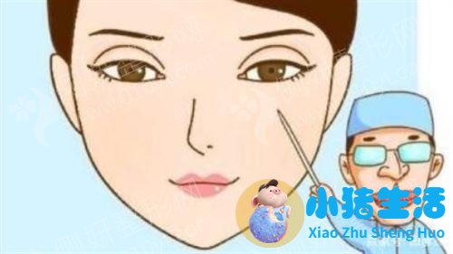 整形失败案例