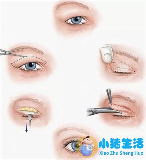 整形失败案例