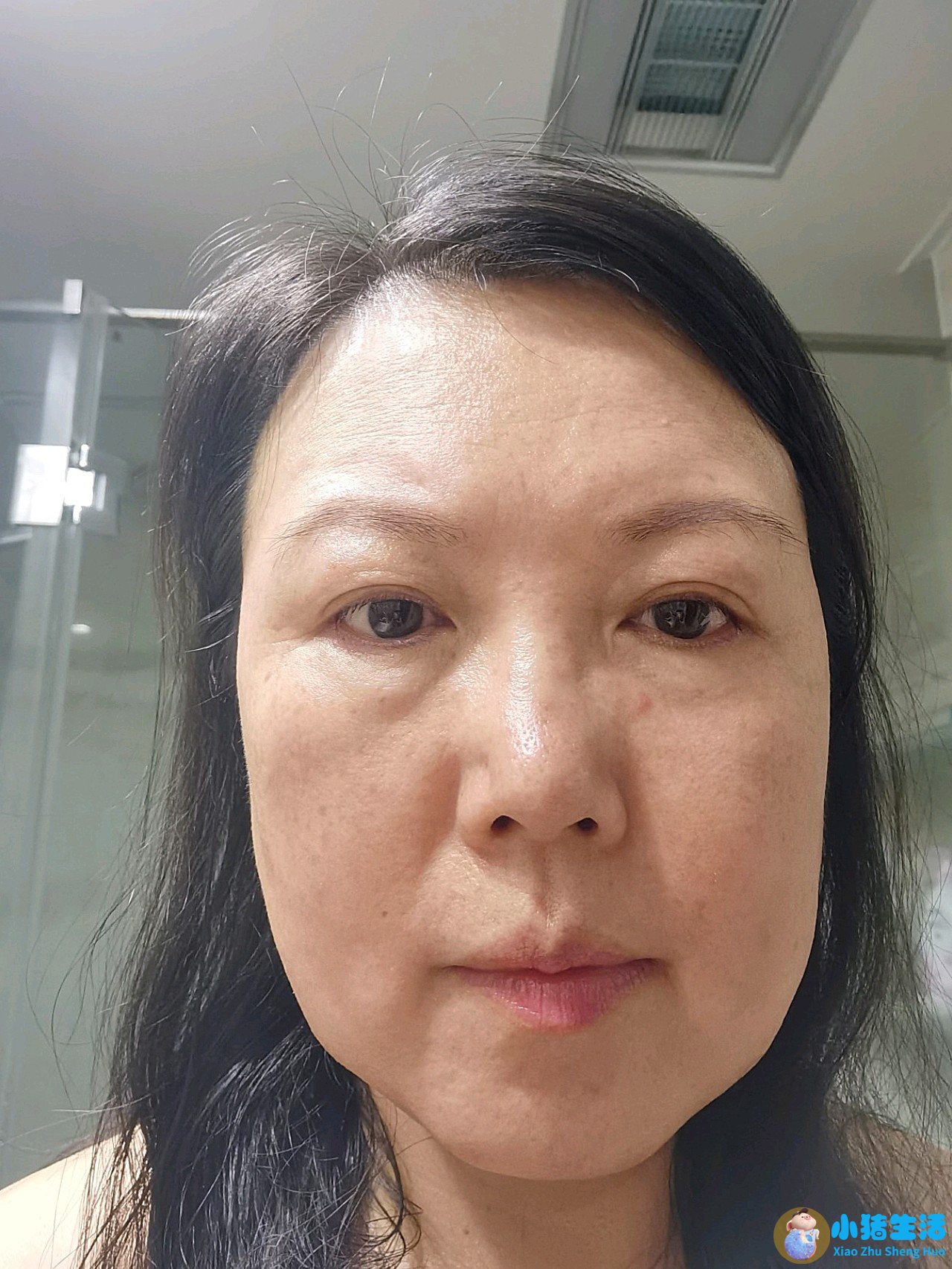 整形失败案例