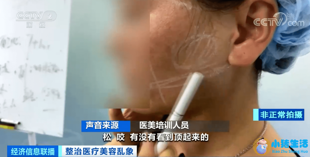 整形失败案例