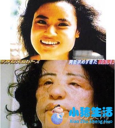 图揭20位最吓人的整形失败女星案例