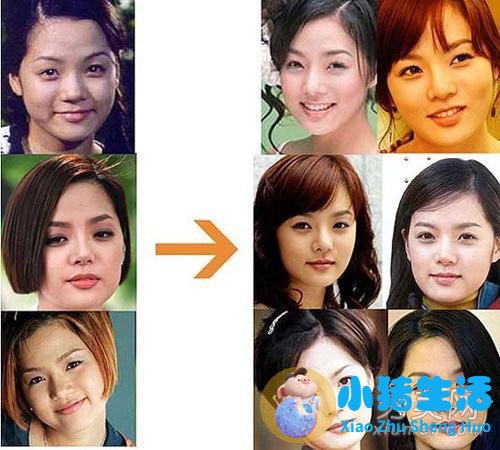 图揭20位最吓人的整形失败女星案例