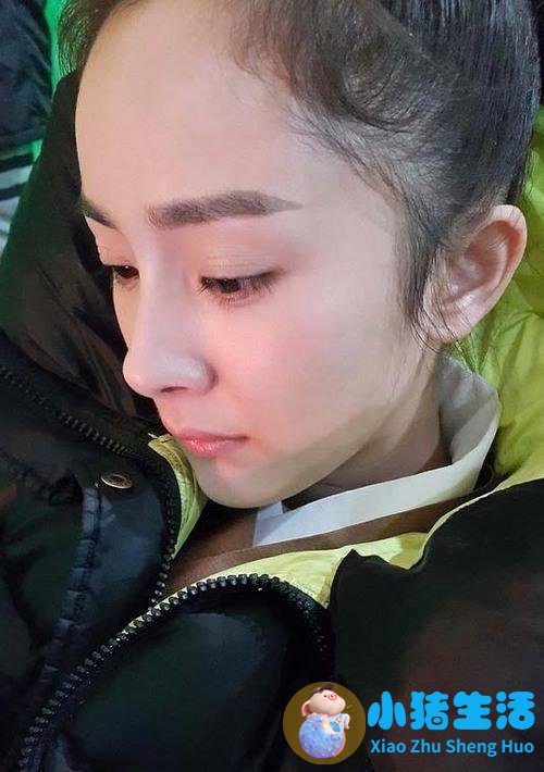 种植头发需要多钱