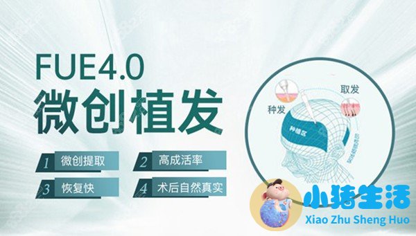 种植头发需要多钱