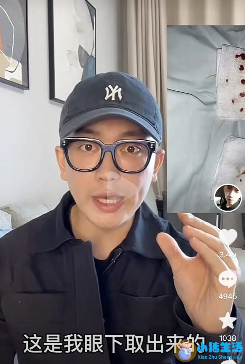 邱立东整形失败案例
