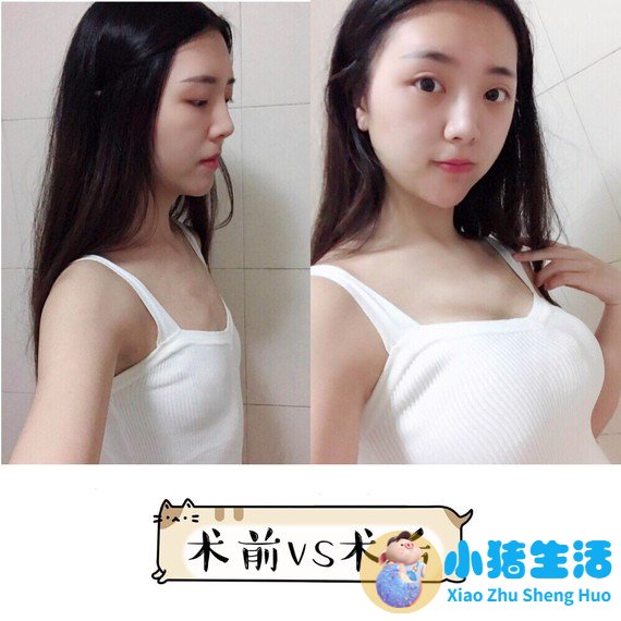 女性夏季养生食谱