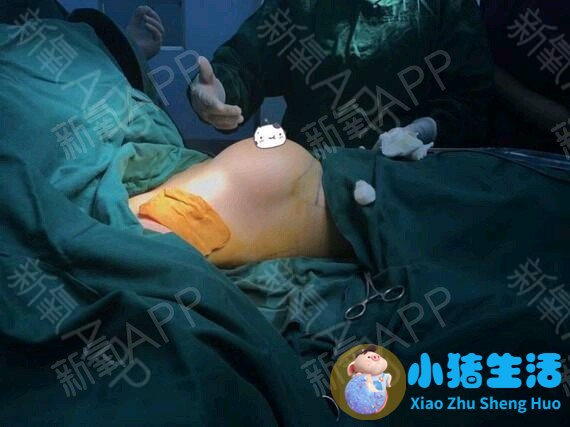 女性夏季养生食谱