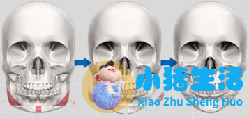 邱立东整形失败案例