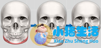 邱立东整形失败案例