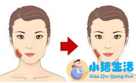 邱立东整形失败案例