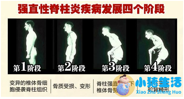 局部减肥的最好方法