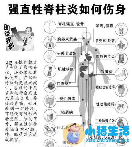 局部减肥的最好方法