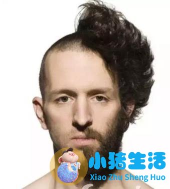 做电波拉皮除皱价