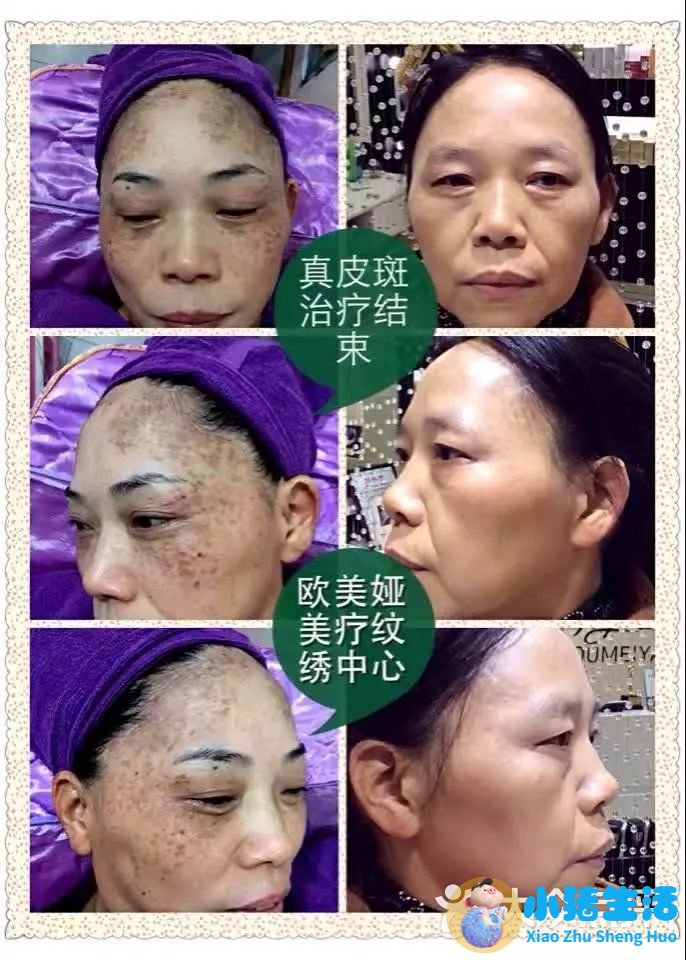 祛斑的产品哪个牌子好