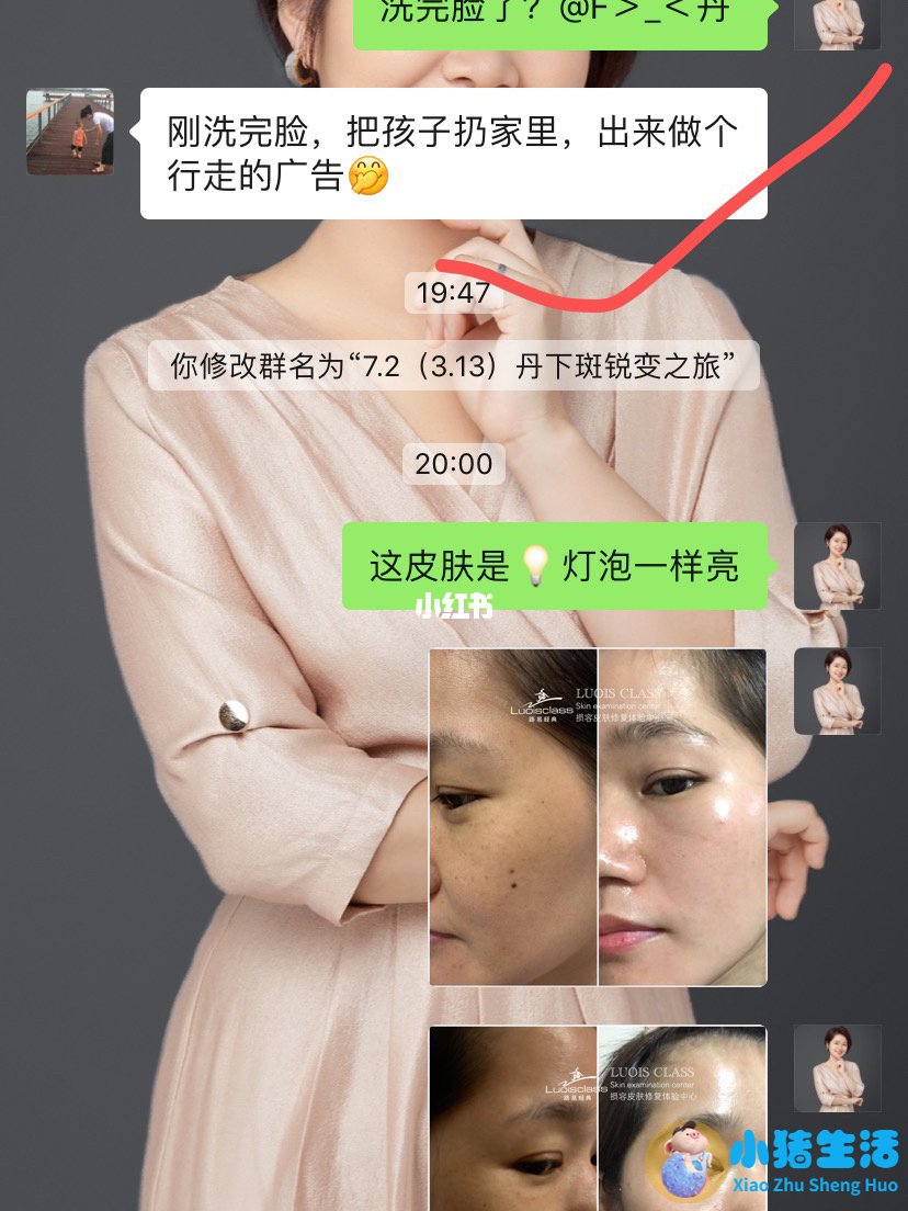 祛斑的产品哪个牌子好