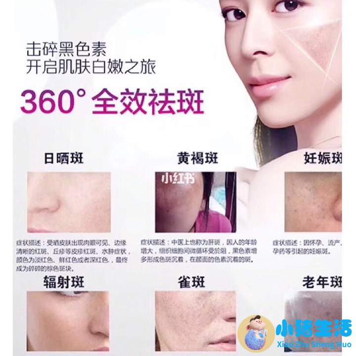 祛斑的产品哪个牌子好
