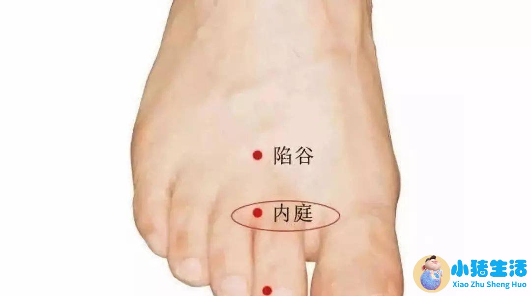 埋线局部减肥