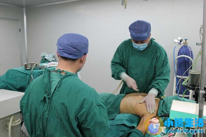 全身抽脂需要多少钱