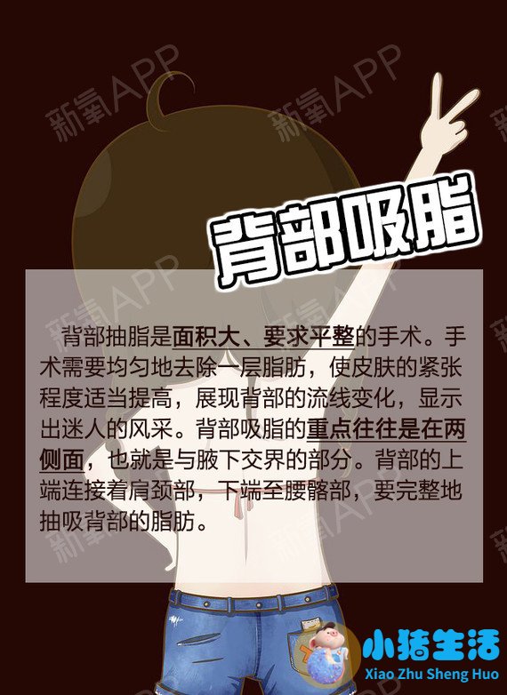 全身抽脂需要多少钱