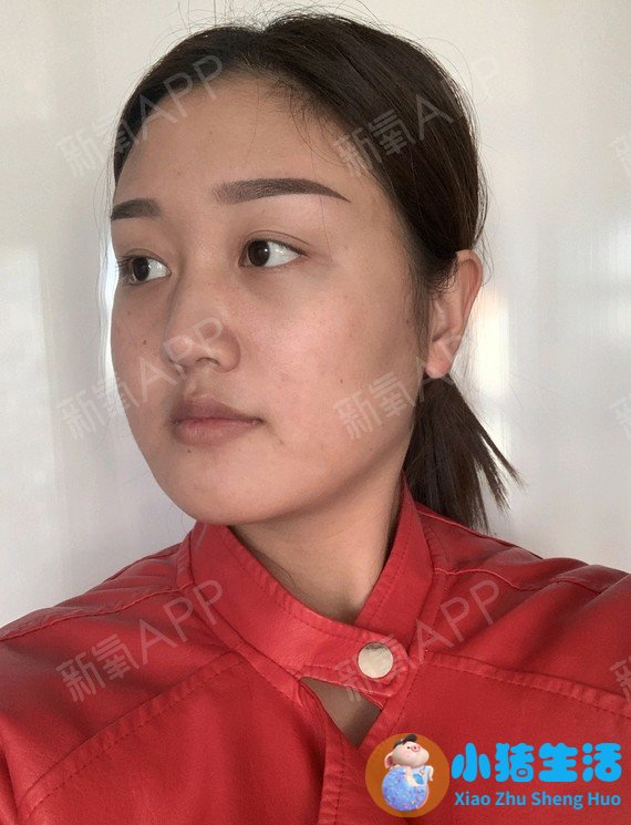 全身抽脂需要多少钱