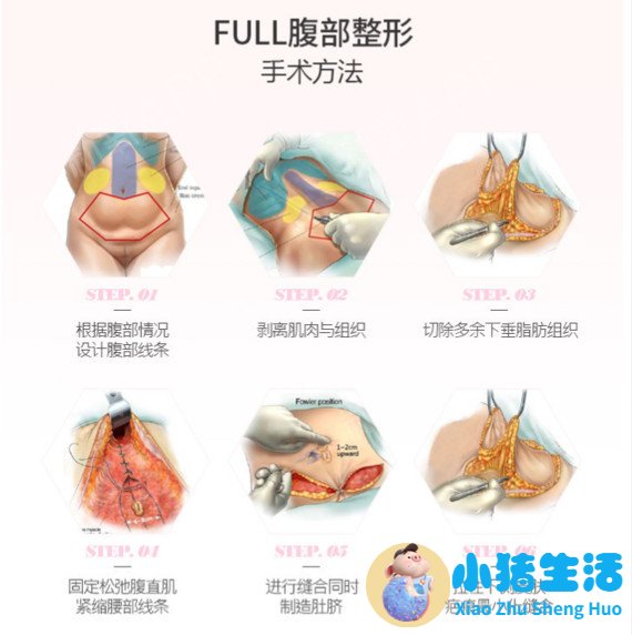 全身抽脂需要多少钱