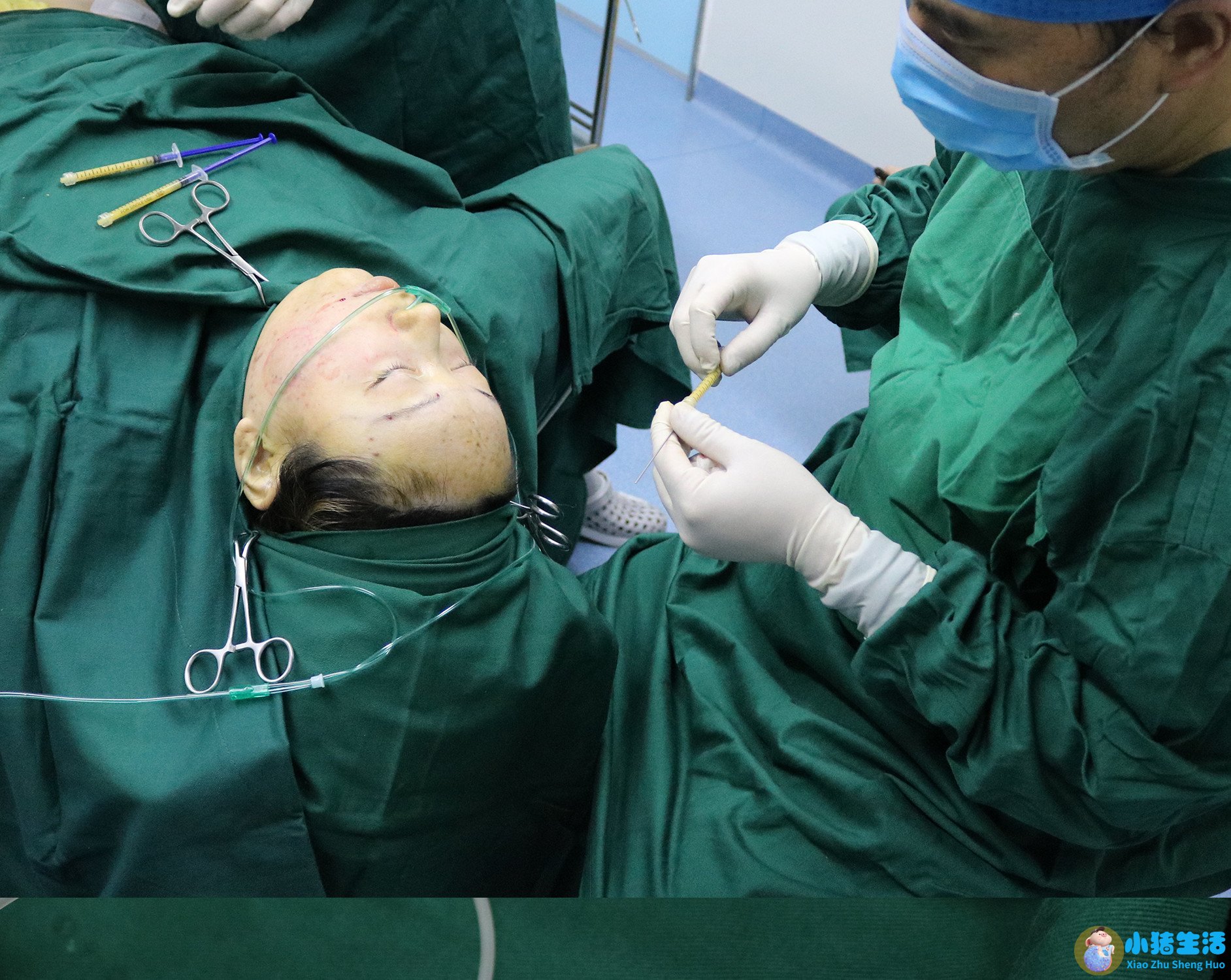 全身抽脂需要多少钱