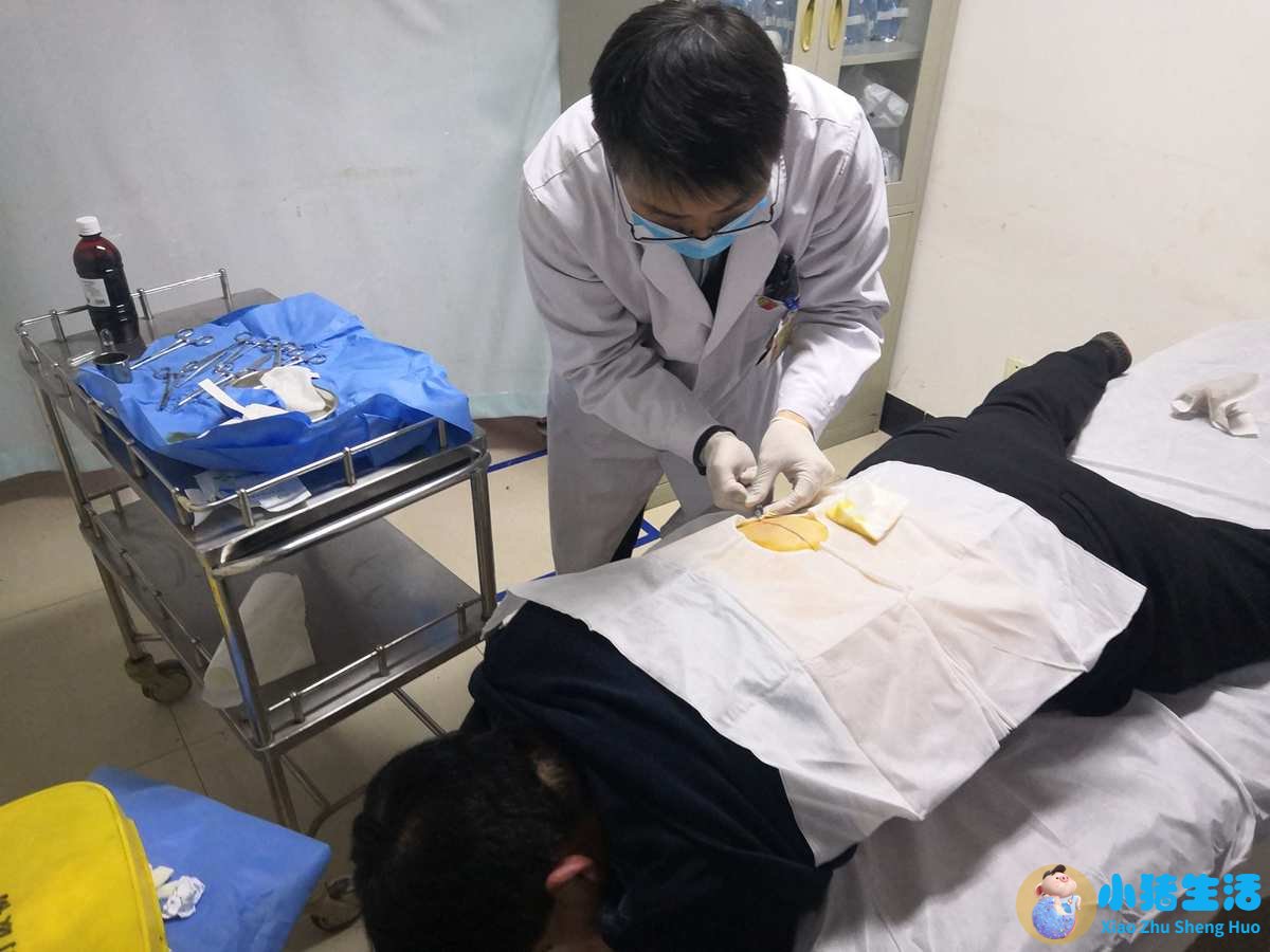 全身抽脂需要多少钱