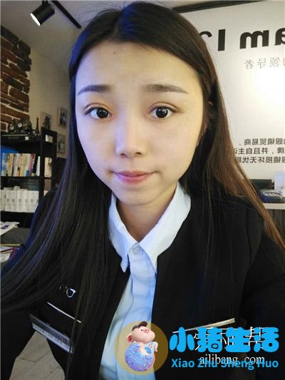 双眼皮整形失败的案例