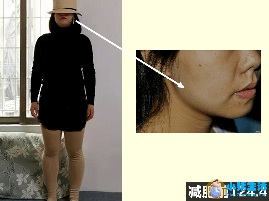不运动减肥成功案例