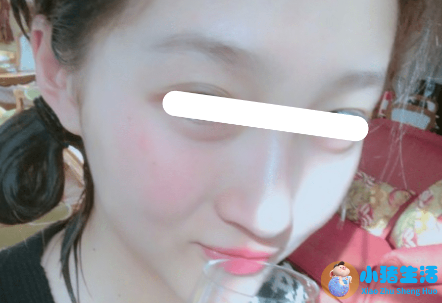 不运动减肥成功案例