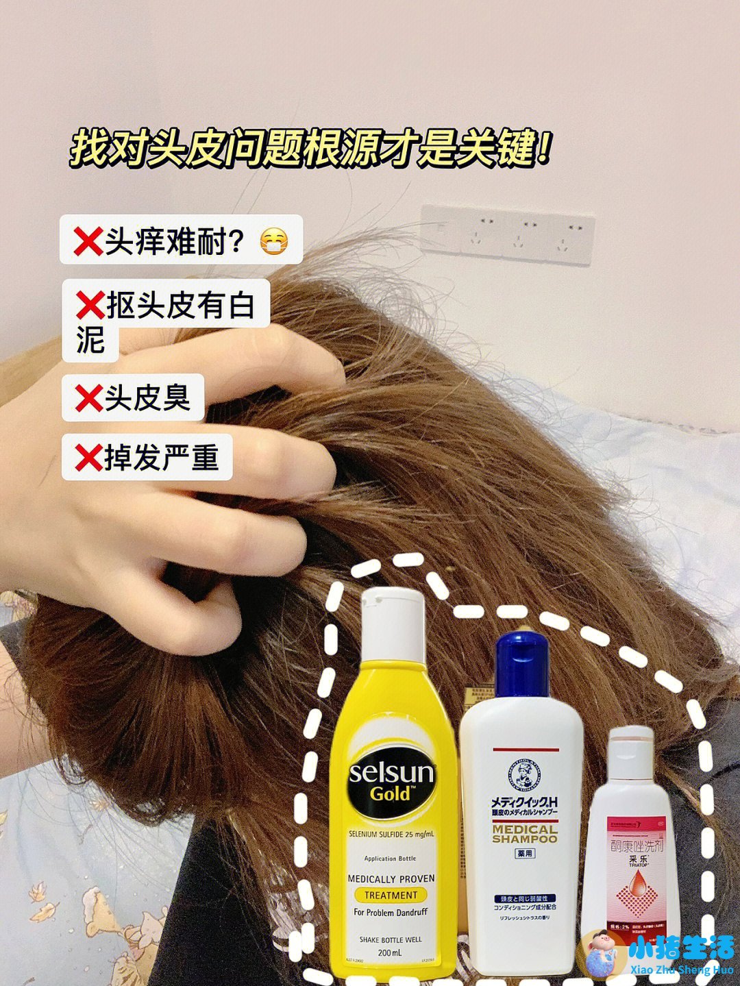头皮上长痘痘没头发