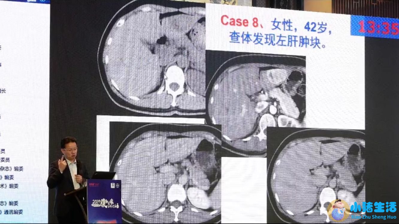 女性下腹胀是什么原因