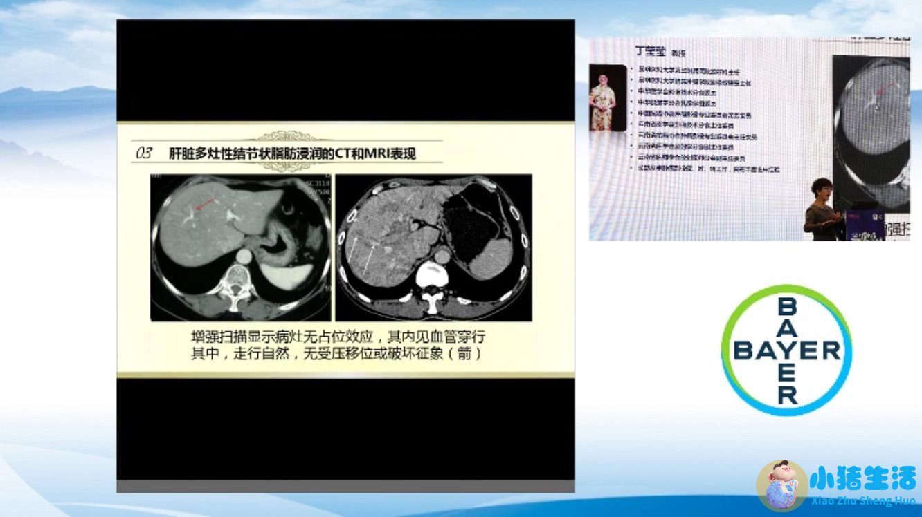 女性下腹胀是什么原因