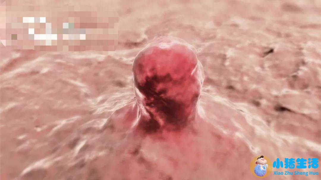 女性下腹胀是什么原因