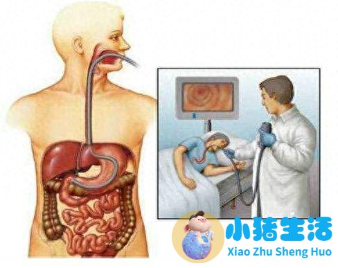 女性下腹胀是什么原因