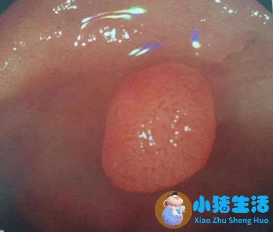 女性下腹胀是什么原因