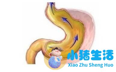 女性下腹胀是什么原因