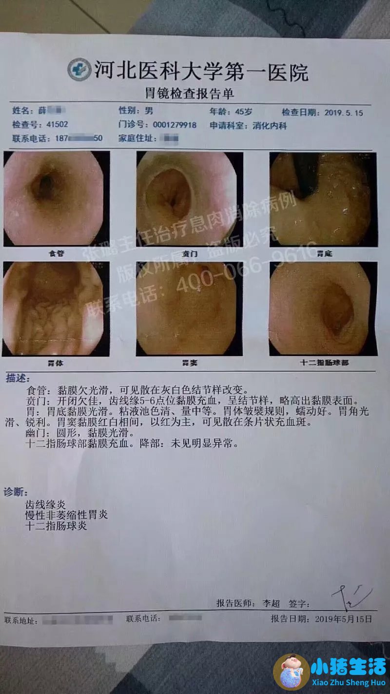 女性下腹胀是什么原因