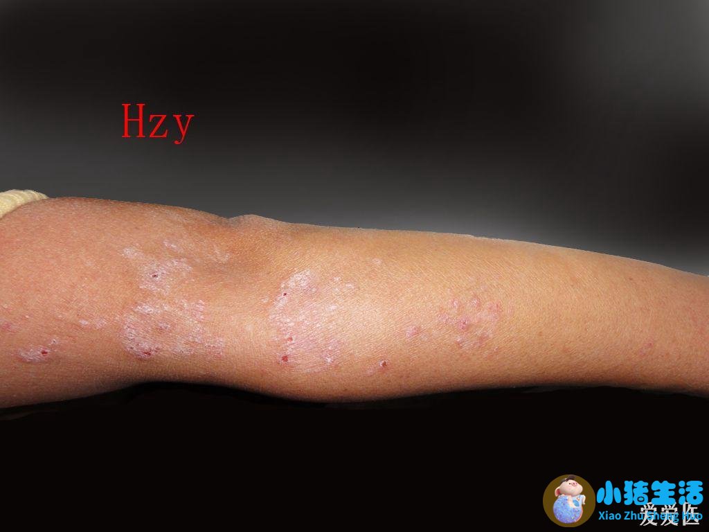 头发有几种类型