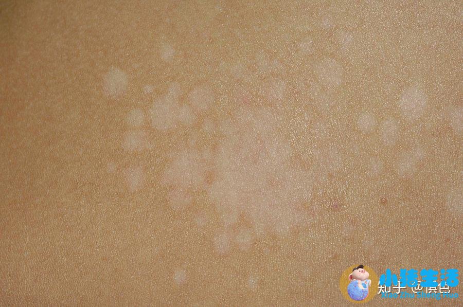 头发有几种类型