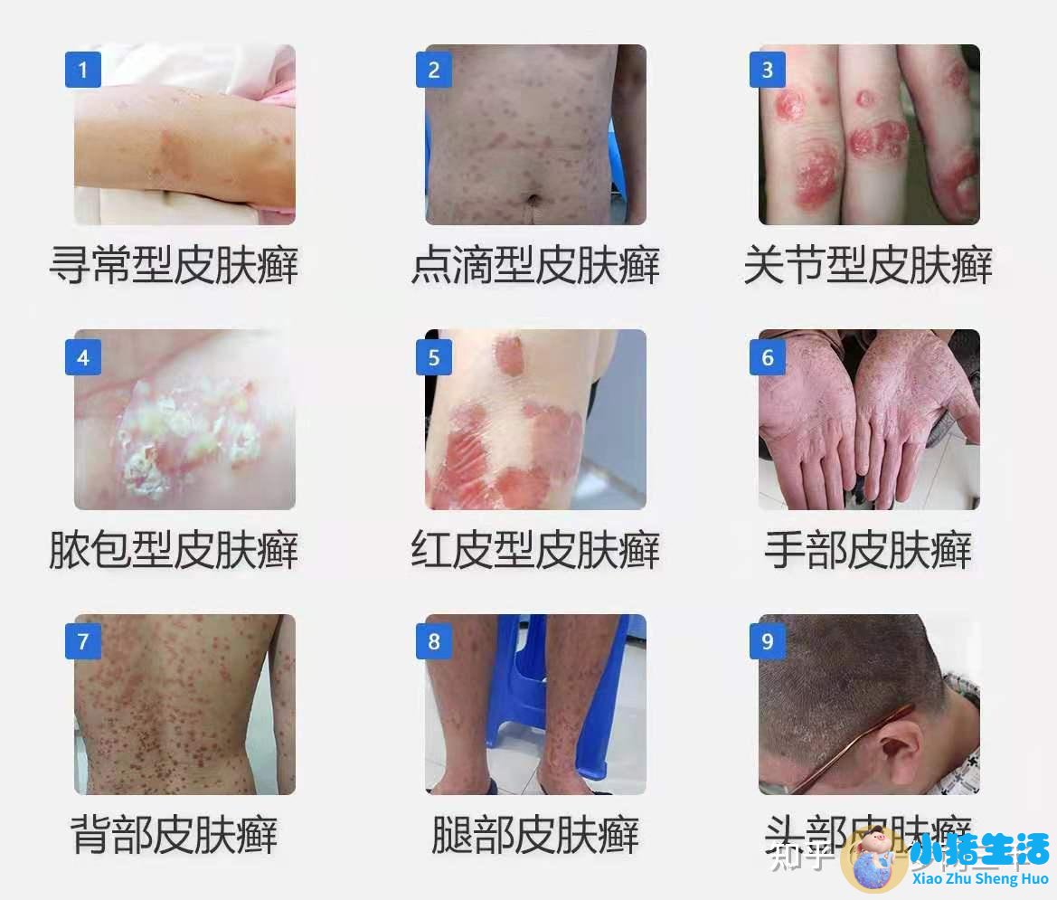 头发有几种类型