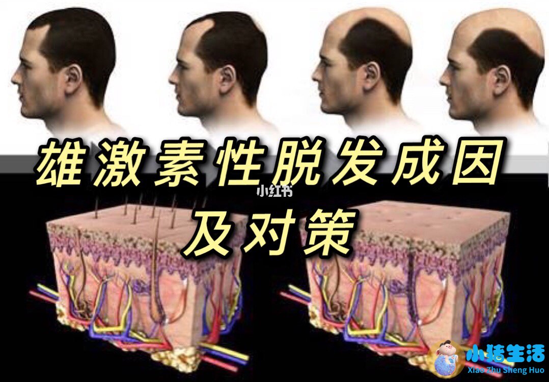 头发有几种类型