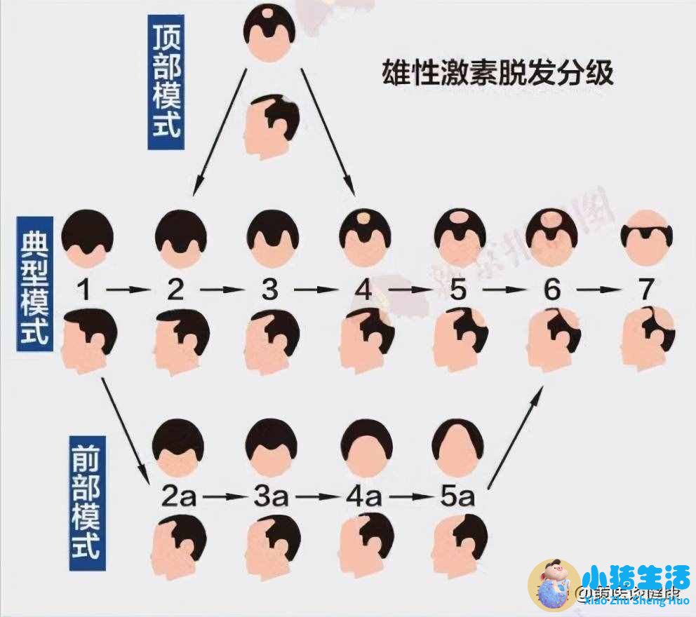 头发有几种类型