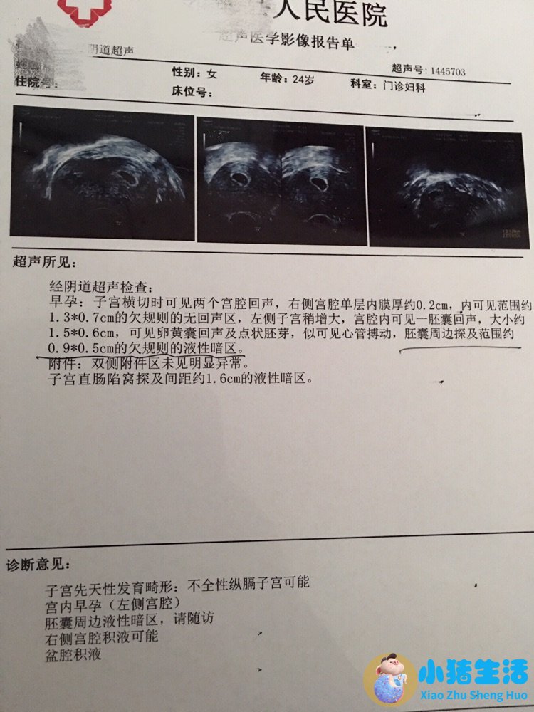 怀孕22周胖多少斤正常