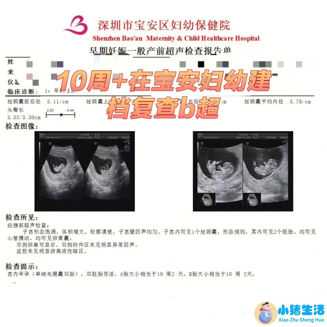 怀孕22周胖多少斤正常